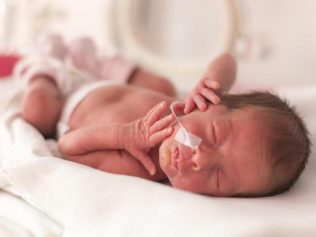Un caso clinico di mal posizionamento di sonda naso-gastrica in un neonato a termine.