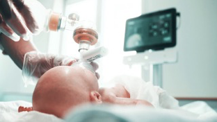 L’ossigeno-terapia nei primi minuti di vita nei neonati prematuri