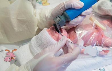 La nebulizzazione del surfattante nei neonati pretermine￼